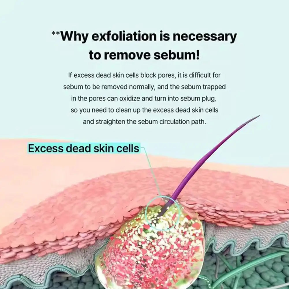 150ML Koorean Blackhead Extractor Toner Super Melting Sebum Softener Stronger Blackhead Cleansing ilso Moisturizing Facial Care Eternal Bloom Co