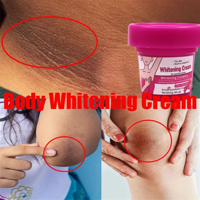 Body Whitening Bleach Cream Brighten Underarm Elbow Knees Joint Removal Intimate Parts Dark Spots Melanin Snow Bleach Cream Eternal Bloom Co